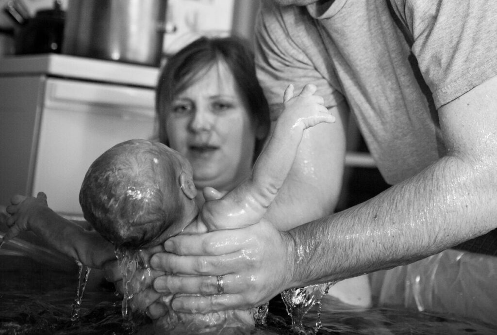 What a Lotus Birth Really Looks Like