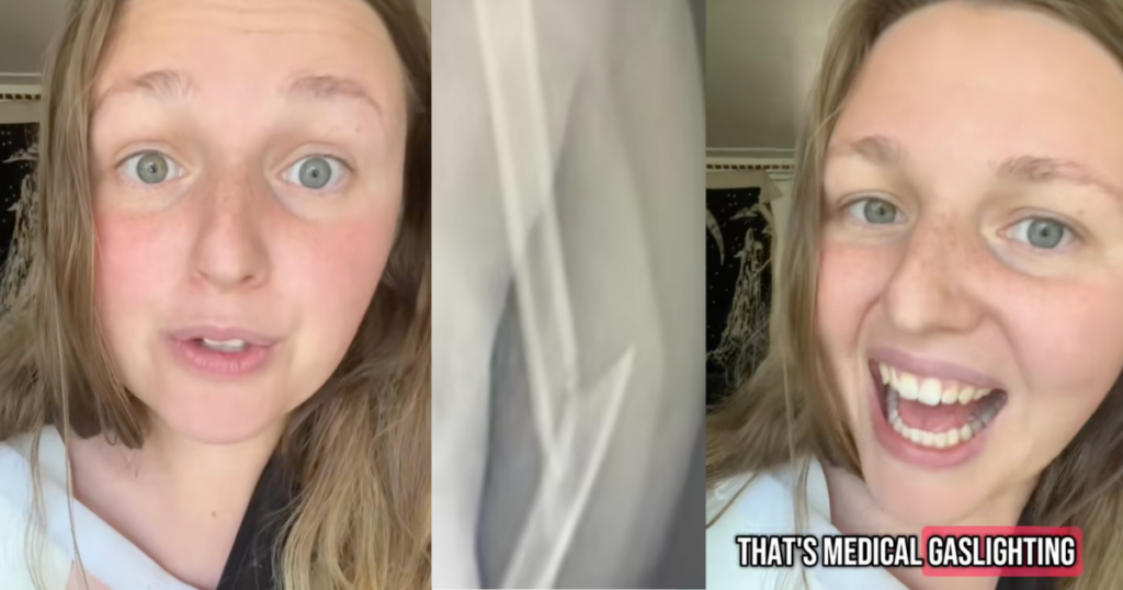 Woman Denied ER Treatment for a Broken Arm Because She Cried — Yes, Really